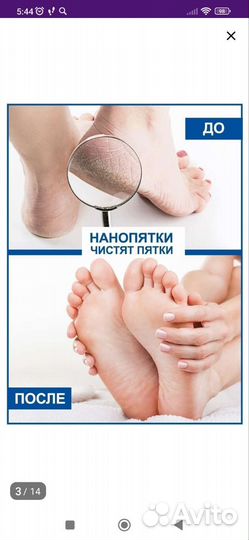 Нанопятки, проф. средство для дом. педикюра