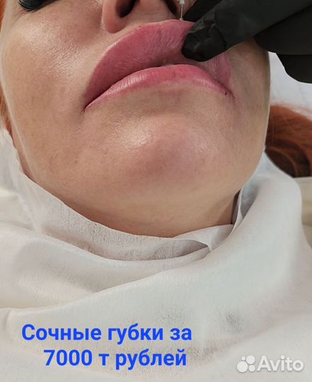 Ботокс для лица модель