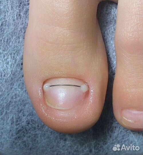 Подолог с медицинским образованием