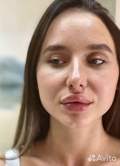 Модель на увеличение губ