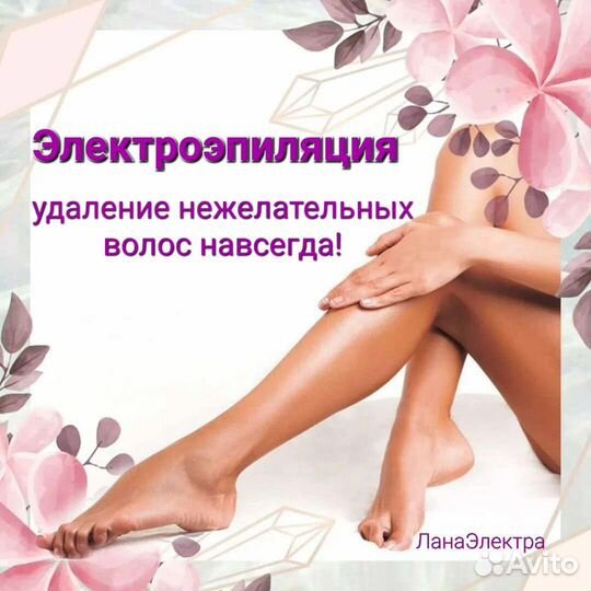 Электроэпиляция