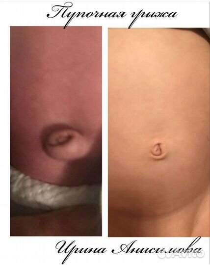 Детский массаж, с выездом на дом