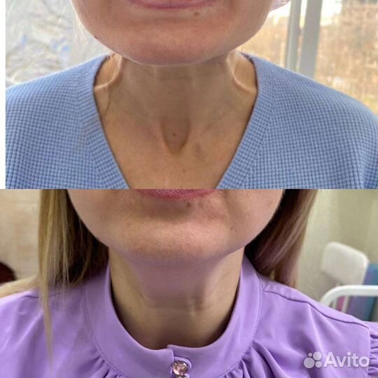 Приглашаю моделей