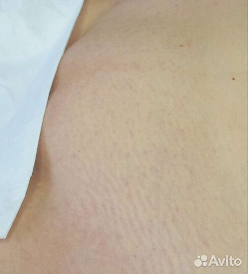 Мастер по шугарингу