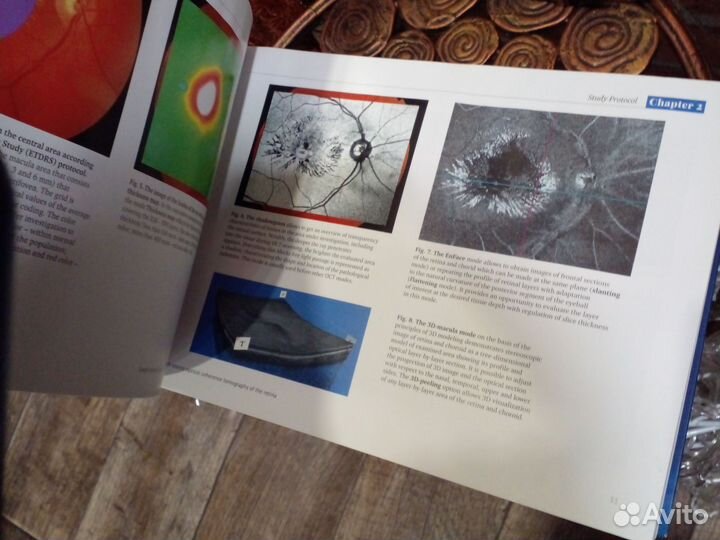 Книга Оптическая томография сетчатки