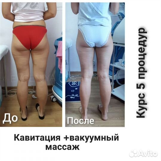 Коррекция фигуры