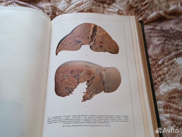 Военная медицина,советская медицина 1941-1945 г