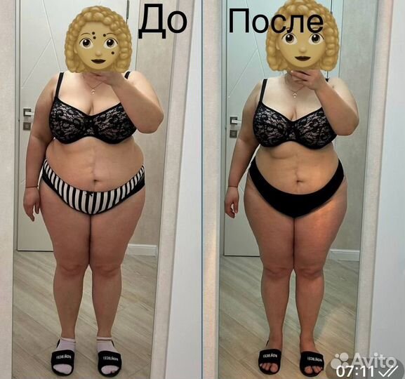 LPG, обертывание бандажное, антицеллюлитное