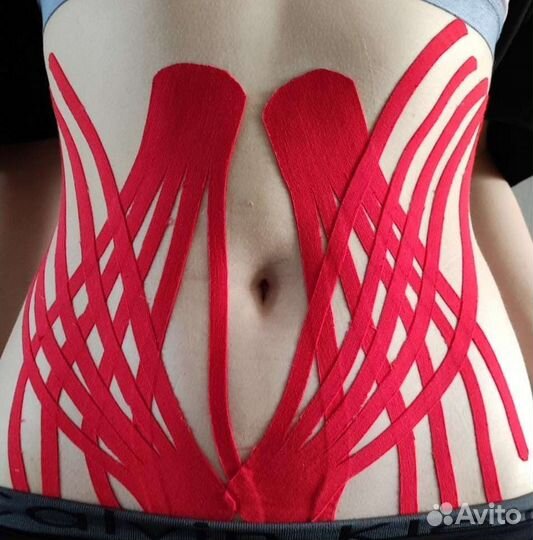 Тейпирование в Соликамске