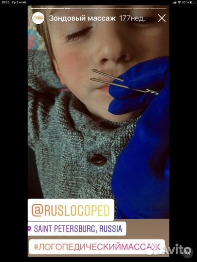 Логопедический массаж