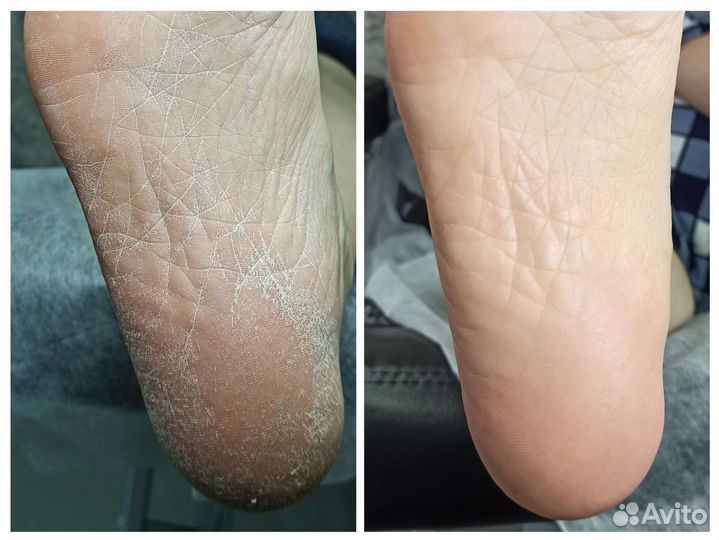 Маникюр, педикюр