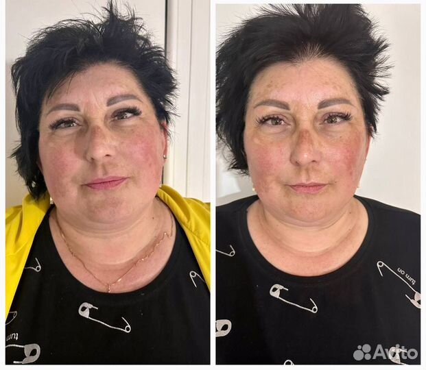 Массаж лица