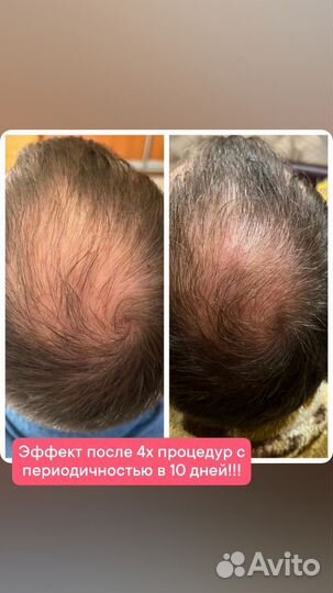 Услуги косметола