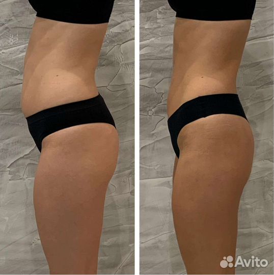 Обертывание горячее минус 3 см/ медовое, парафин