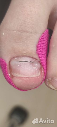 Подолог (Солнечный 2 )