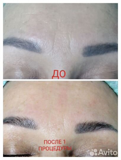 Оздоровительный массаж фохоу