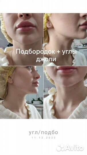 Услуги косметолога