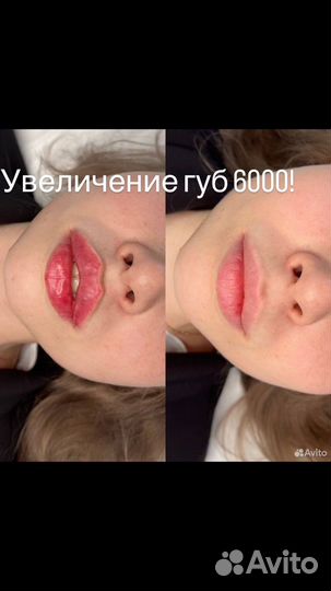 Нужны Модели косметологу