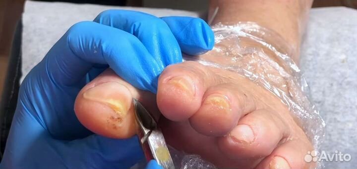 Педикюр для пожилых с выездом на дом