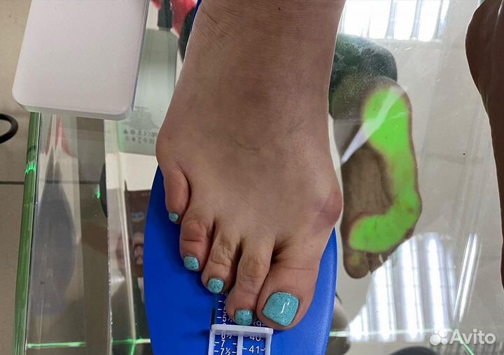 Изготовление индивидуальных ортопедических стелек