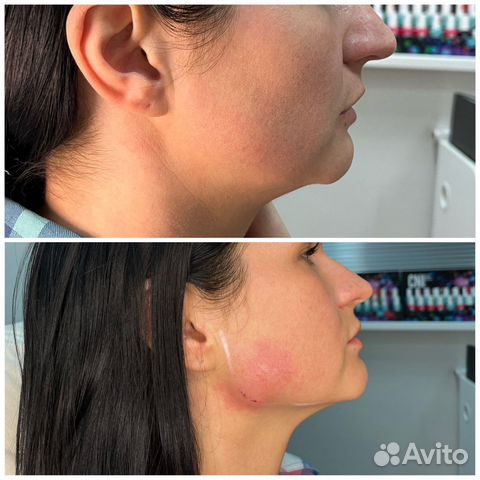 Услуги косметолога