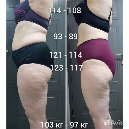 Коррекция фигуры с гарантией результата