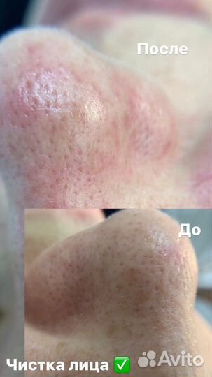 Косметолог эстетист