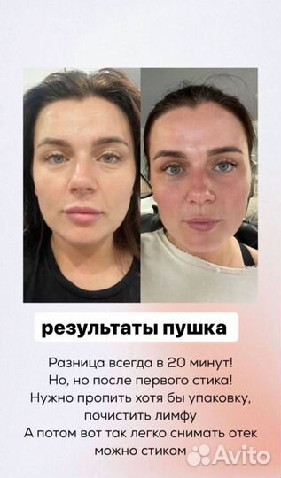 Драйнэффект