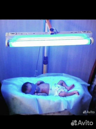 Лампа от желтушки