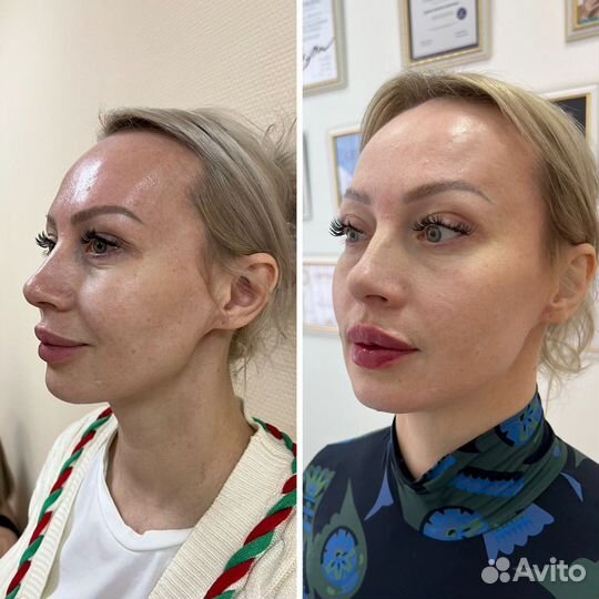 Услуги косметолога