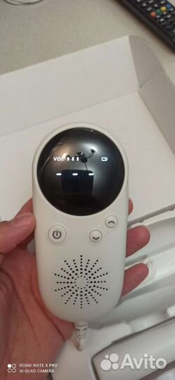 Фетальный допплер