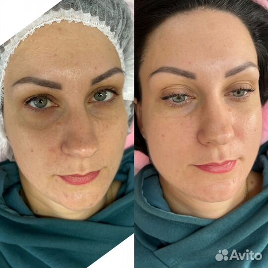 Наращивание ресниц модель