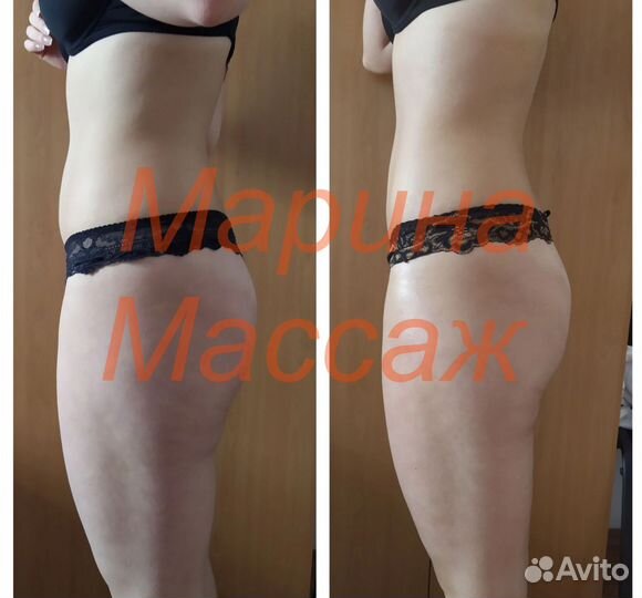 Массажист Коррекция фигуры Похудение Массаж лица