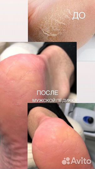 Подолог с выезжом на дом