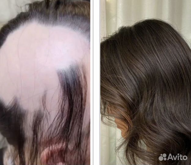 Накладки из натуральных волос имитация кожи