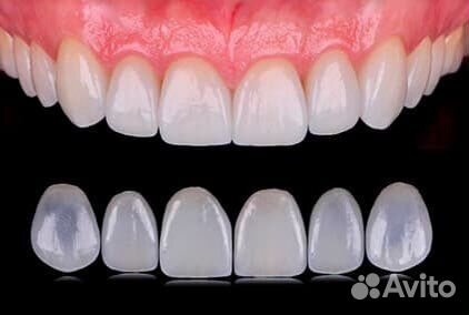 Изготовление эстетических коронок