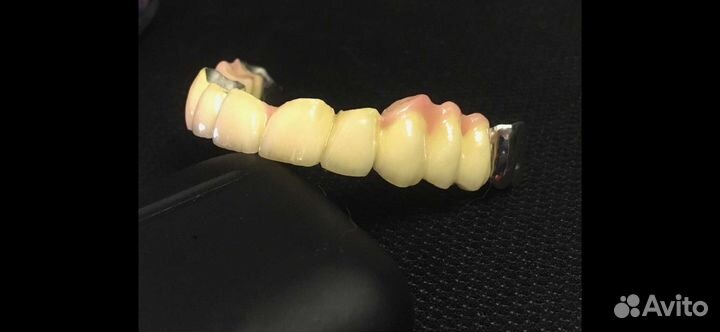 Зубной техник-керамист