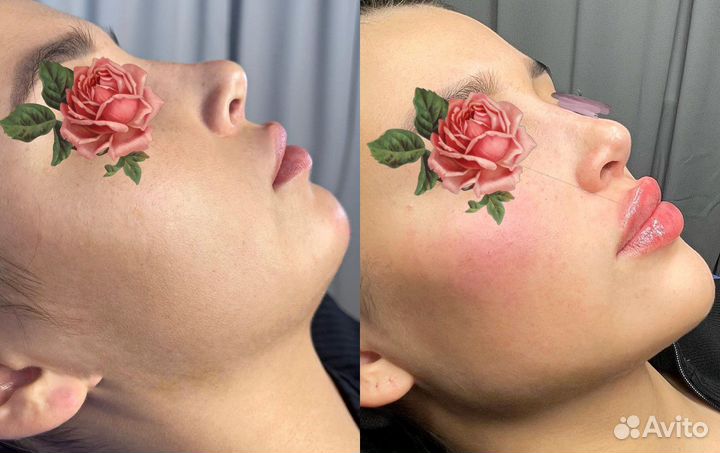 Лицо под ключ, Фулл Фейс, Овал Джоли