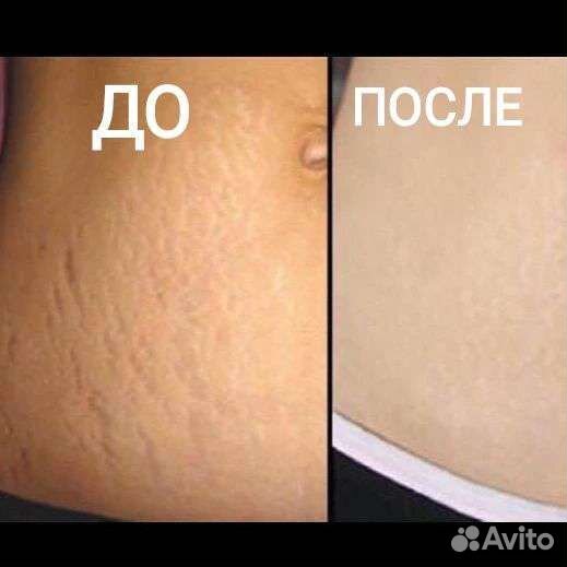 LPG, Слимсфера