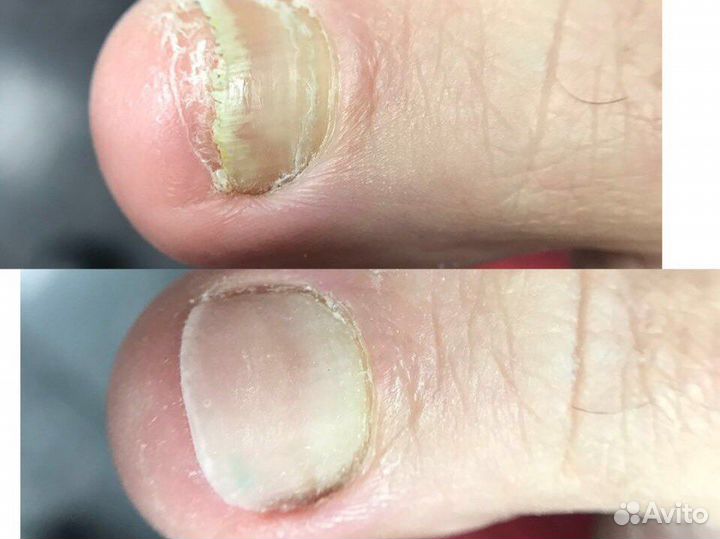 Педикюр Маникюр Гель- лак