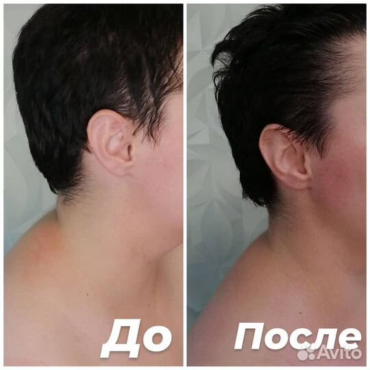 Массаж на дому