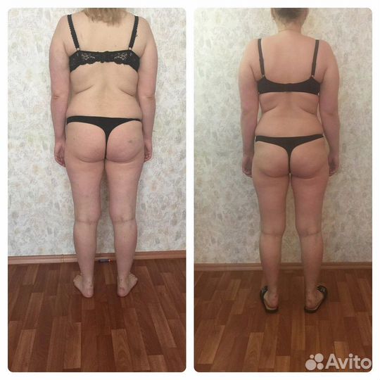 Антицеллюлитный массаж тела