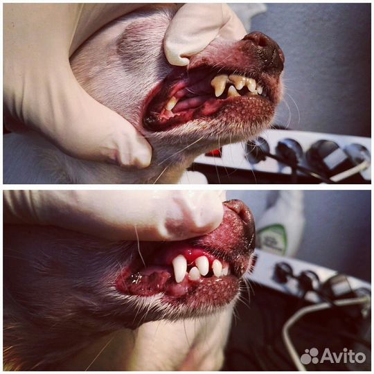 Чистка зубов ультразвуком, со шлиф. Без наркоза