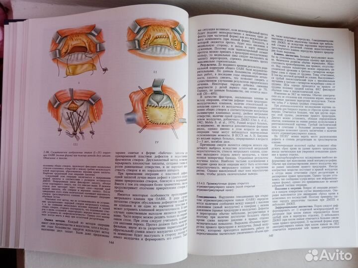 Сердечно-сосудистая хирургия руководство