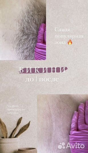 Депиляция на дому