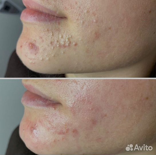 Инъекционная, аппаратная косметология