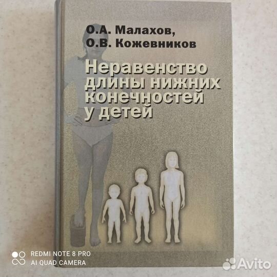 Неравенство длины нижних конечн. у детей, Малахов