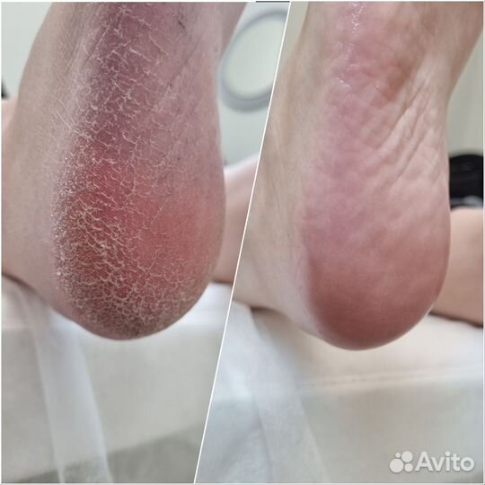 Мастер маникюра и педикюра