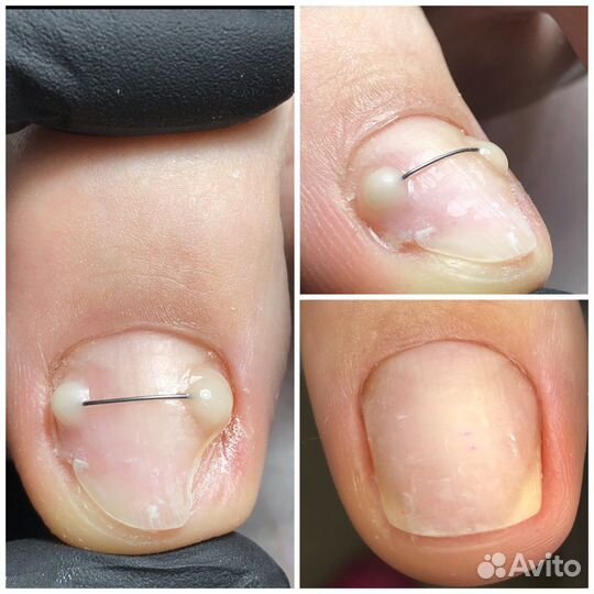 Педикюр гмр, подолог гмр