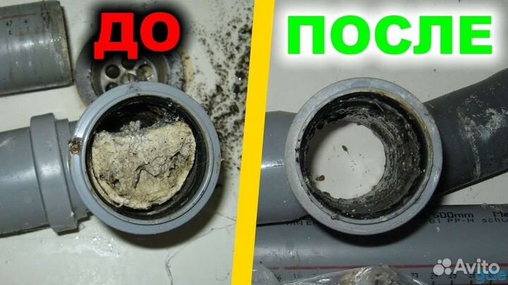 Устранение засоров видеодиагностика